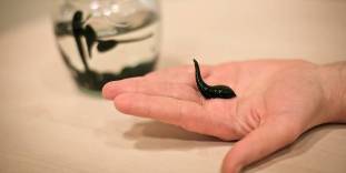 leech therapy