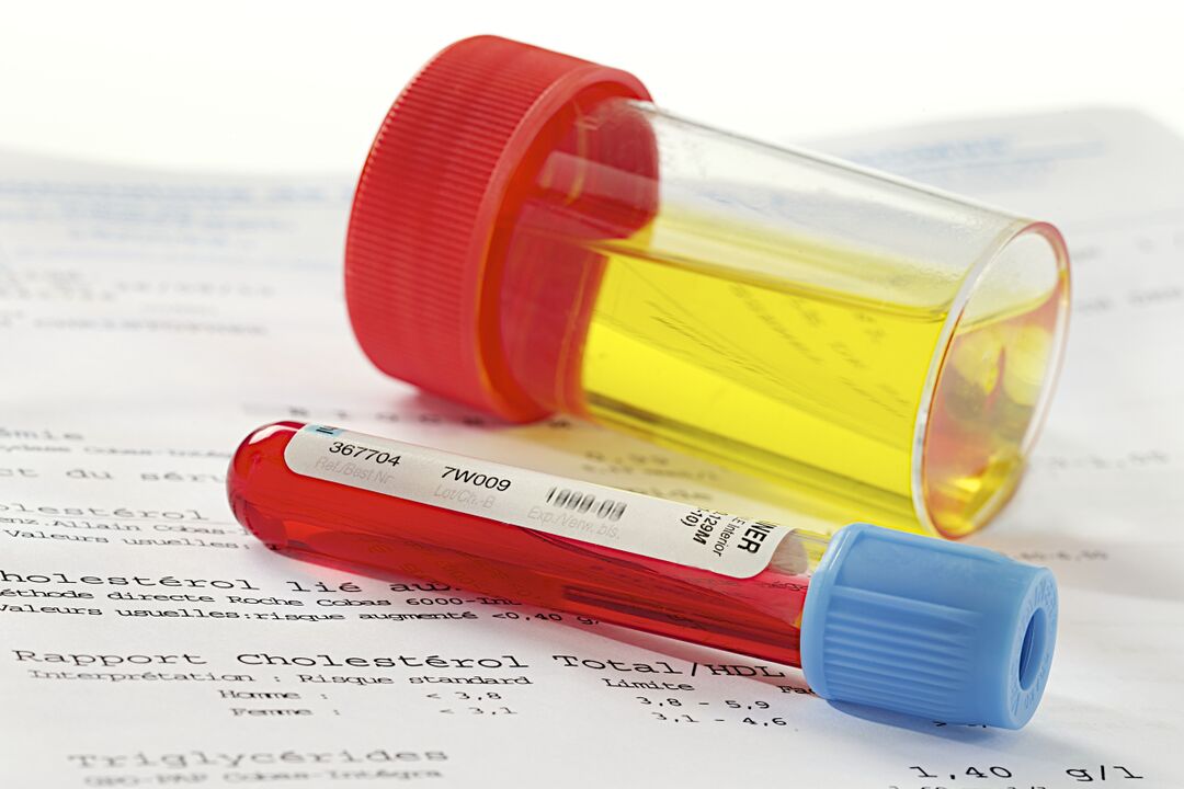 Blood and urine analysis will help determine the presence of prostatitis.